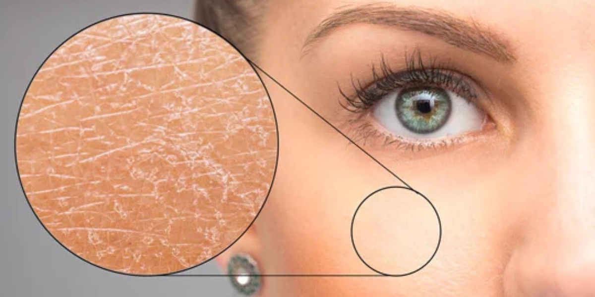 Analisi gratuita della pelle con La Roche-Posay, Vichy e CeraVe